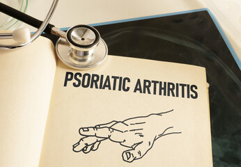 Psoriatic Arthritis is shown using the text