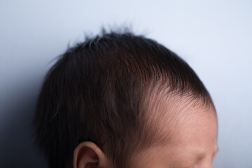 Tiny little newborn human baby head forehead pate