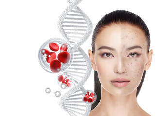 acne treatment concept - obrazy, fototapety, plakaty
