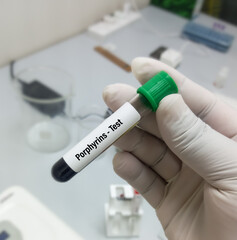Test Tube with blood sample for Porphyrin test, neurologic porphyria. A medical testing concept.