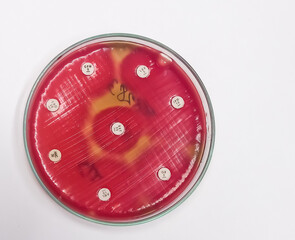 Antimicrobial susceptibility testing in petri dish,Gram-positive coccus,Streptococcus pyogenes or Group A streptococcus (GAS)