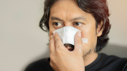 Adult Asian man having a nasal bandage, over soft beige color background with copy space.