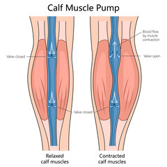 blood flow in relaxed and contracted calf muscles, indicating valve positions and muscle states structure diagram hand drawn schematic vector illustration. Medical science educational illustration © Oleksandr Pokusai