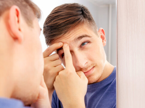 Young Man with a Pimple