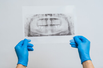 Jaw radiography image. Dental x-ray of pacient oral cavity with teeth