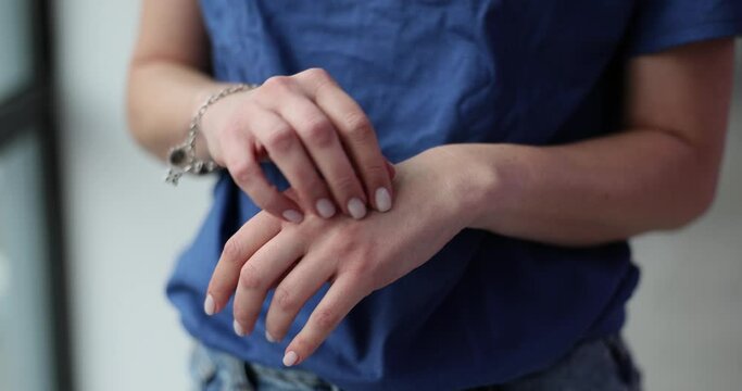 Woman scratches skin of hands at site of irritation and itching