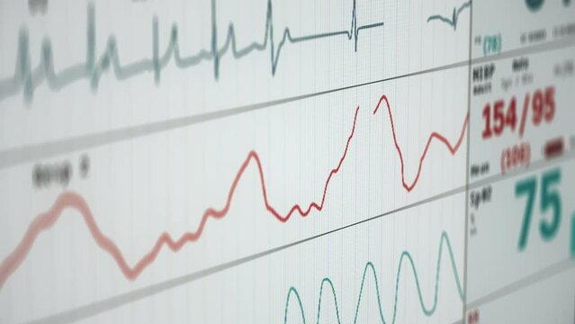 Performing health check test on a patient suffering from heart disease. Testing the heart condition enduring the serious disease. Detecting failure of patients heart during medical disease test.