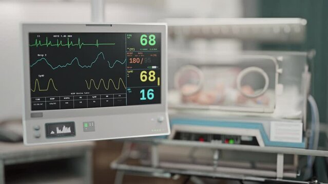 Pulse tracking equipment detecting danger to a young patient at a clinic. Monitor noticing a dangerous change in a child patient pulse. Alarming dangerous decrease in a baby patient pulse.
