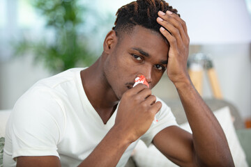 young man with tissue in his nostril - obrazy, fototapety, plakaty