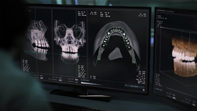 Doctor inspects the dental xray scans of the injured patient. Observing the dental xray scans imaging to identify the treatment. Multiple dental xray scans displaying the damaged teeth in a jaw.