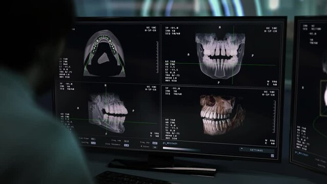 Dental professional inspecting the x-ray examination scan imaging of a jaw. Using dental exam scanner to identify teeth problems. Studying the dental exam scan of a skull from different angles.