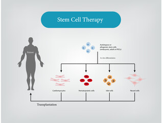 Cancer Stem Cell Therapy Vector and Illustration
