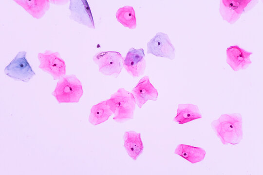 View in microscopic of human skin cells.Squamous epithelium cells.Superficial and intermediate epithelial cells.Cytology and pathology laboratory department.Magnification 400 X