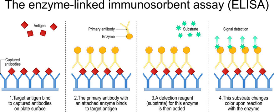 Enzyme-linked immunosorbent assay. The steps of A sandwich ELISA test