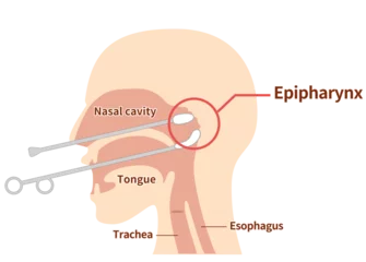Fotobehang How to perform and illustrate Epipharyngeal Abrasive Therapy B-spot therap © sumaki