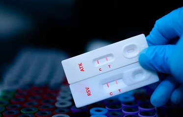 The sample of patient positive tested for ATK and RSV by rapid diagnostic test.