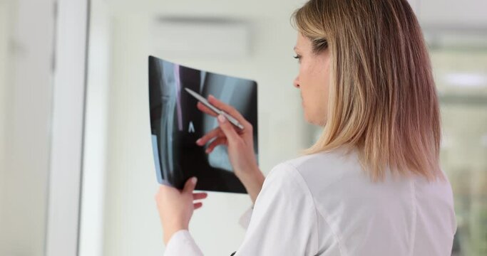 Traumatology examines results of x-ray of hand