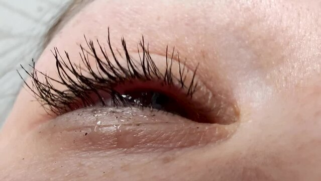 Closeup young woman drops eye drops. Macro shot of a woman using medical eyes drops