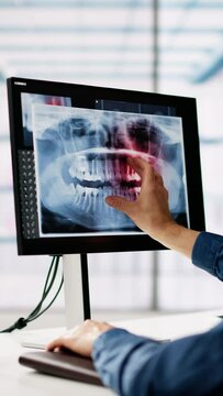 Mature Male Dentist Looking At Teeth X-ray On Computer