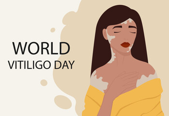 Young caucasian girl illustration with vitiligo banner. World Vitiligo Day. - 783219077