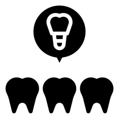 IMPLANT,molar,dental,teeth,medical.svg