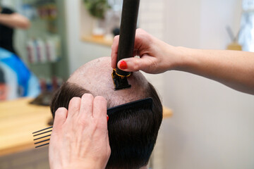 Technician trims hair meticulously for prosthesis fit.
