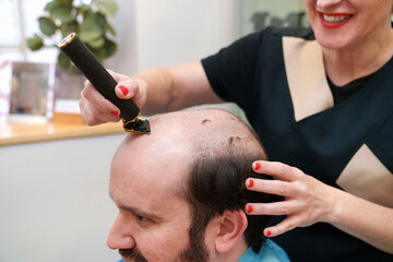 Expert cuts remaining hair before hairpiece fitting.