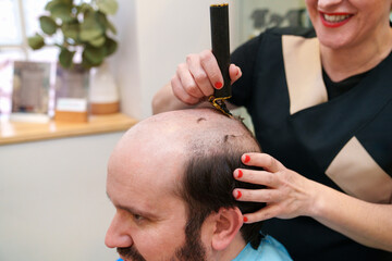 Barber prepares to apply hair prosthesis on client