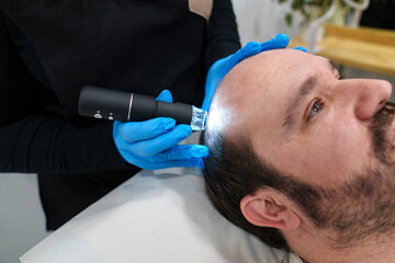 Professional performing scalp treatment on a male patient.