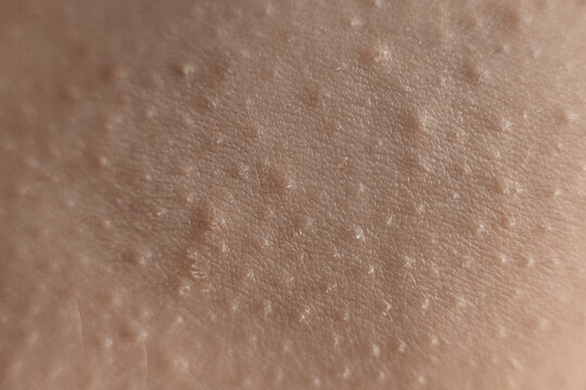 Real Skin Texture Abstract Close-up 