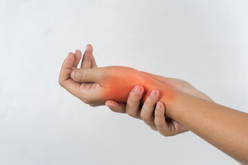 A person's hand is red and swollen, possibly from an injury.