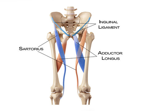 Femoral Triangle Boundaries - sartorius, adductor longus, inguinal ligament