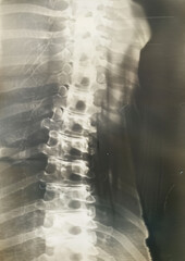 X-ray of bones. Aesthetics of X-rays. Generative AI - 783730613