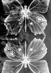 X-ray poster. Aesthetics of X-rays. Generative AI - 783730655