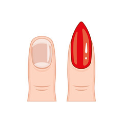 A close up of a fingernail with a red tip. The nail is painted with a red polish. 