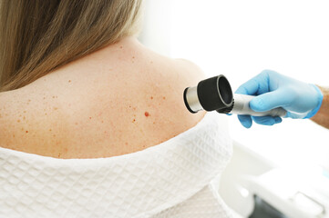 Obraz premium a dermatologist examines moles and skin growths on the patient's body using a special device - a dermatoscope. Diagnosis and prevention of melanoma.