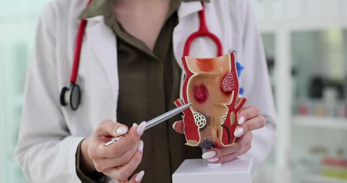 Proctologist shows an artificial model of the human rectum