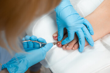 Patient on medical pedicure procedure and treating nail disease in the clinic.