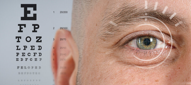 eye doctor checkup concept