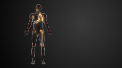 Prognosis and staging of Lymphoma