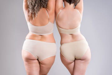 Two overweight women with cellulitis, fat flabby back, hips and buttocks on gray background, obese female body, liposuction, plastic surgery and body positive concept - 785049642