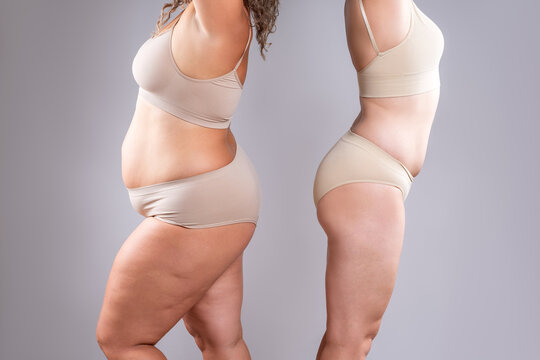 Two overweight women with cellulitis, fat flabby bellies, legs, hands, hips and buttocks on gray background, obese female body, liposuction and plastic surgery concept