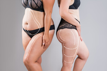 Tummy tuck, two overweight fat women with cellulitis, flabby bellies, obesity hips and buttocks on gray background, liposuction and plastic surgery concept with surgical lines and arrows