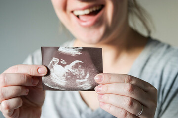 Close up top view of a happy woman holding an ultrasound picture of her baby