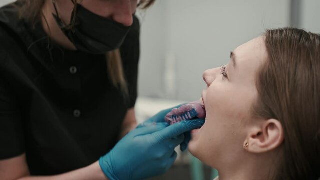 The orthodontist using dental impression tray on woman teeth. Dental spatula with print for dental implant.