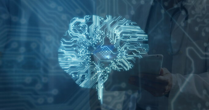 Image of brain with computer circuit board over diverse doctors - Powered by Adobe