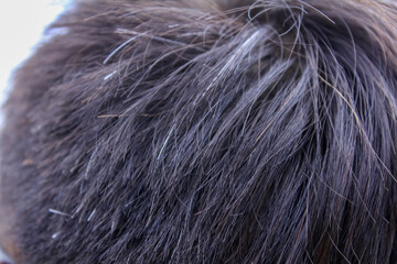 Fototapeta premium Close-up of a man hair with few gray hair. Man hair, black hair.