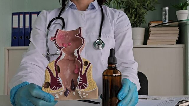 The doctor holds Vaseline oil for constipation in the rectum. Anatomical model of rectum with hemorrhoids