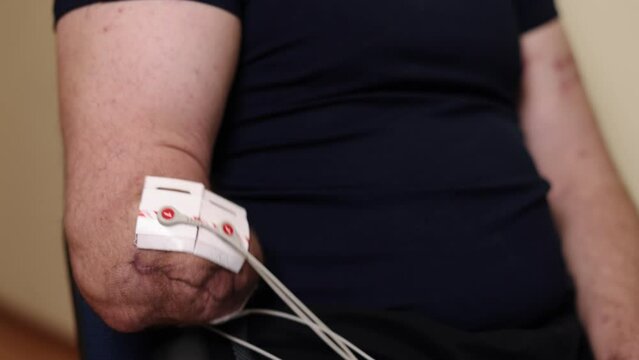 Rehabilitation technology, Electrotherapy procedure, Muscle conditioning. Image zooms in on patient's arm, where electrodes for electrotherapy are applied, highlighting non-invasive approach