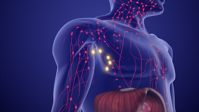 Medical Animation for Lymphoma Staging and Prognosis